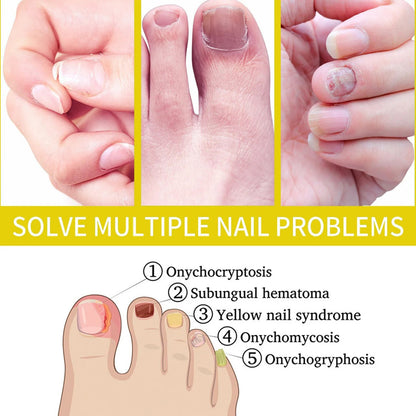 Velora Nail Growth Serum