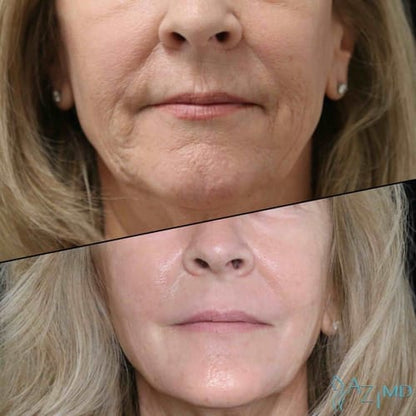 Velora Instant Face Tightener® No-Filter Primer